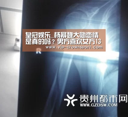 皇冠娱乐_杨幂魏大勋恋情是真的吗?男方喜欢女方13年(图2) 皇冠体育官网